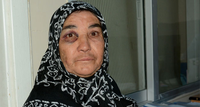 55 yıllık kocasından dayak yiyen kadın hastanelik oldu