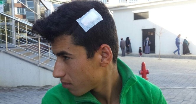 Suriyeli çocuğun kafasında fayans kırıldı