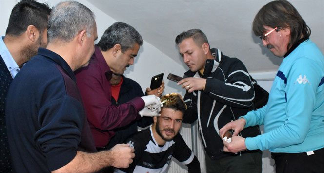 Kafası yarılan futbolcuya belediye başkanı dikiş attı