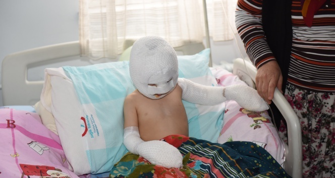 Yangında yaralanan çocuk için seferber oldular