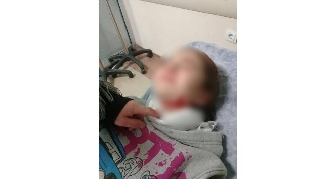 Köpeklerin saldırısına uğrayan çocuk ölümden döndü