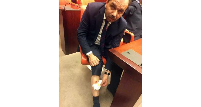 TBMM’de CHP Milletvekili, AK Partili Balta’yı bacağından ısırdı