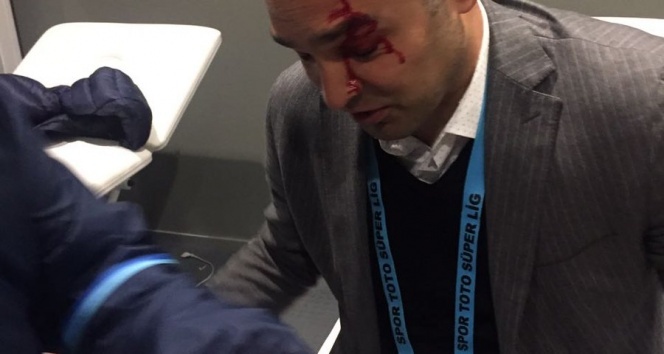 Hasan Çetinkaya'nın kafası yarıldı