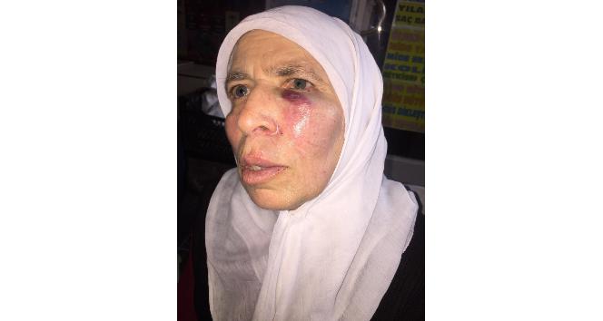 İzmir’de yaşlı kadın acımasızca yumruklandı