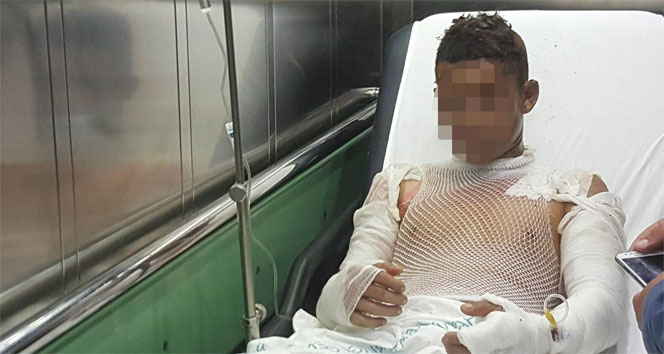 Samsun&#039;da çakmak gazı parladı: 4 çocuk yaralı