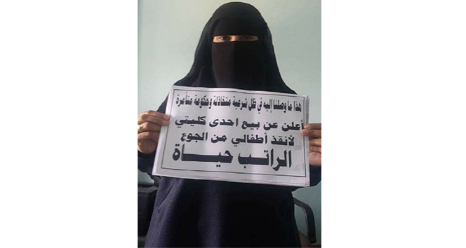 Yemenli kadın çocukları için böbreğini satışa çıkarttı