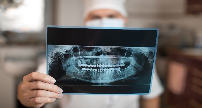 Diş röntgeninde radyasyon riskine karşı önlem şart