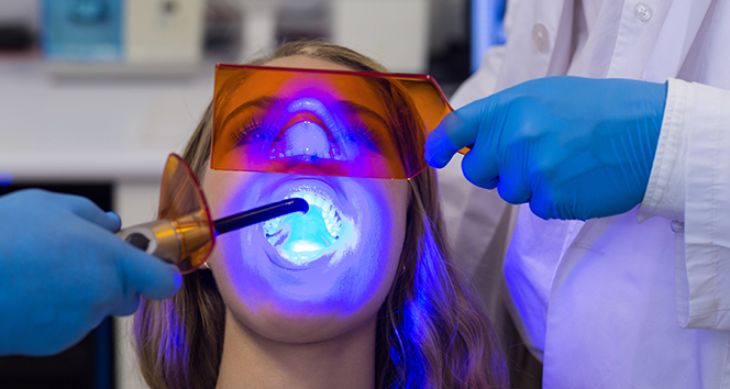 Diş tedavisinde lazer kullanımı riskli mi?