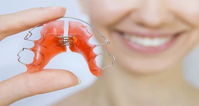 Ortodontide telsiz tedavi mümkün mü?