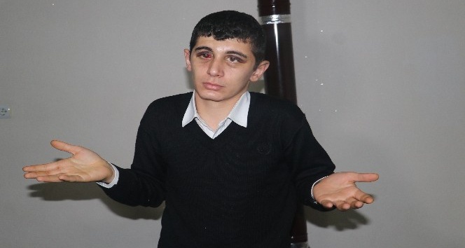 Engelli Agit’i dövenler için 4,5 yıl hapis istendi