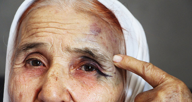Antalya’da 80 yaşındaki kadına eski gelininden sokak ortasında dayak iddiası