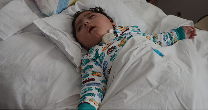 Ömer Ali'nin tek çaresi beyin kök hücre ameliyatı