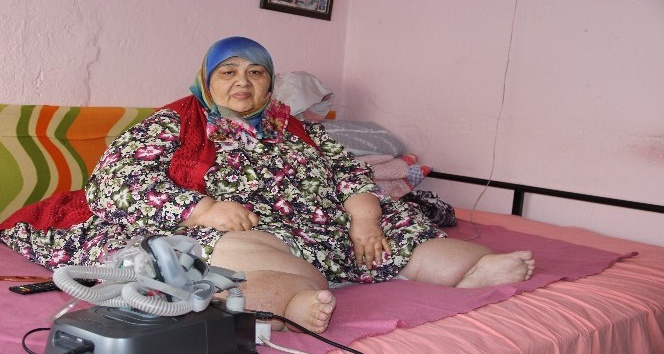 260 kilo ağırlığındaki kadın kilo verebilmek için yardım bekliyor