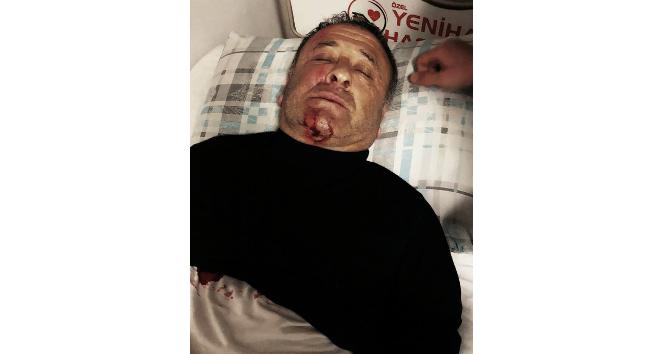 Osmaniyesporlu eski futbolcu saldırıya uğradı