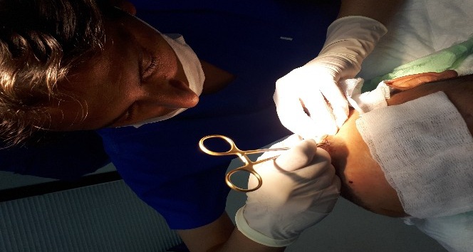 Saç ekiminde ’Çim adam’ olmayın