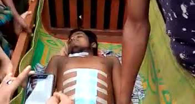Bangladeş’te Arakanlı Müslümanın hastanede organları çalındı