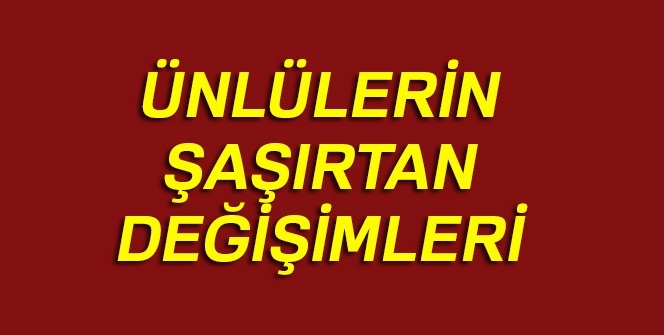 İşte ünlülerin yıllar içerisindeki şoke eden değişimleri