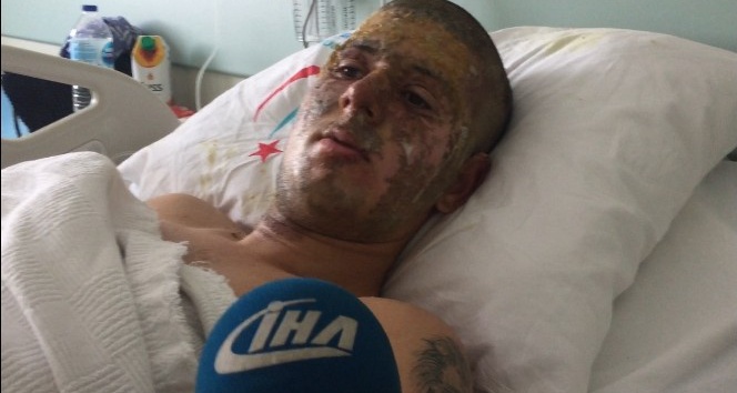 Elektrik trafosunda ölüm kalım savaşı