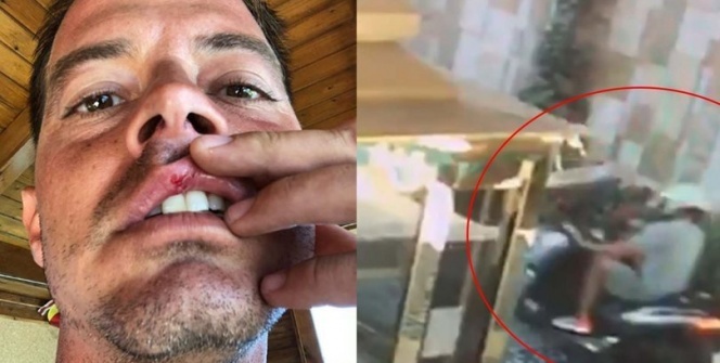 Alp Kırşan kaza geçirdi!