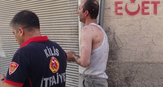 Kilis’te ev yangını: 1 yaralı