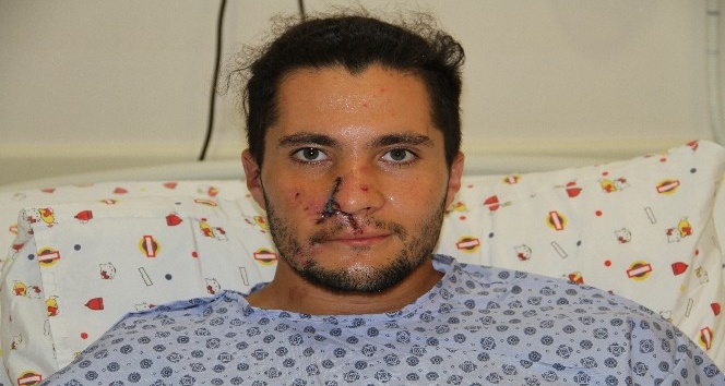 Alanya’da kazada burnu kopan Rus gence kulağından alınan doku ile burun yapıldı