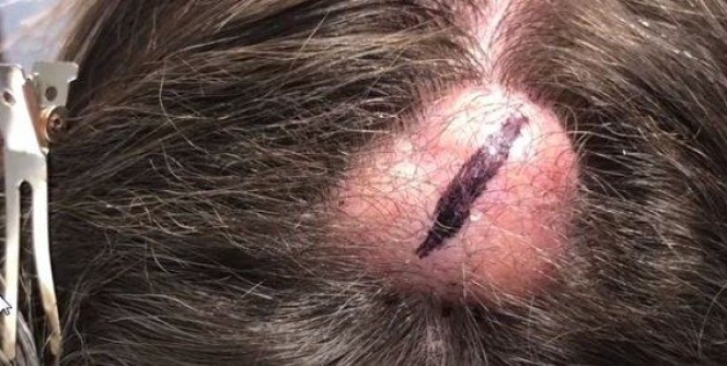 20 yıl bu şekilde yaşadı! Kafasından çıkanlar şoke etti