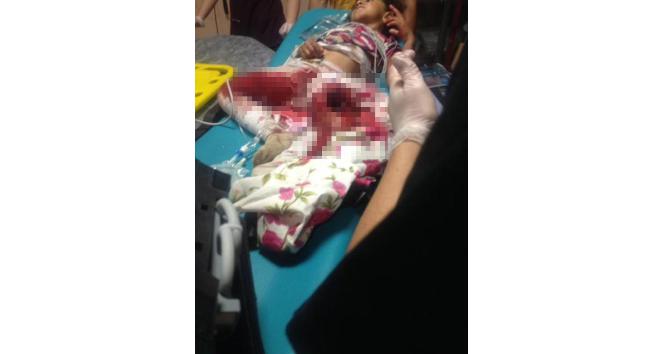 Kars’ta patos makinesine düşen kız çocuğu ağır yaralandı