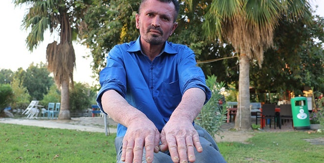 Eskiden insanlar korkup kaçıyordu, şimdi gören sarılıyor