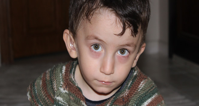 Minik Buğra biyonik kulak ameliyatı için yardım bekliyor