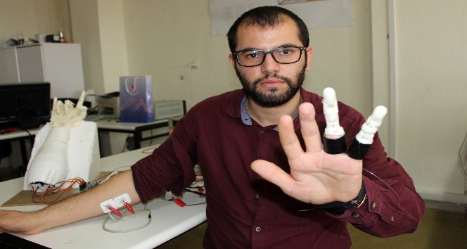 İki parmağını kaybeden mühendislik öğrencisi, kendine protez parmak yaptı