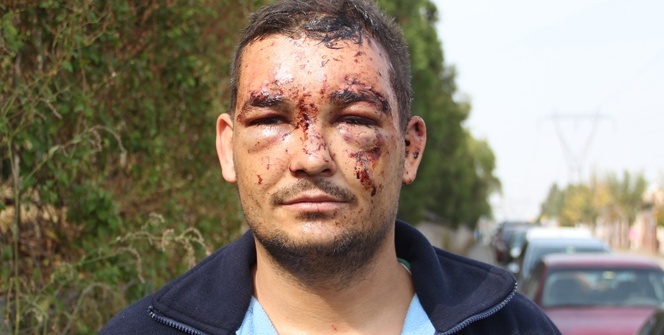 Her yeri yara bere içinde... Bakın onu bula ne getirdi!