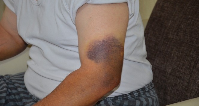 Denizli’de sokak ortasında demir sopayla dayak