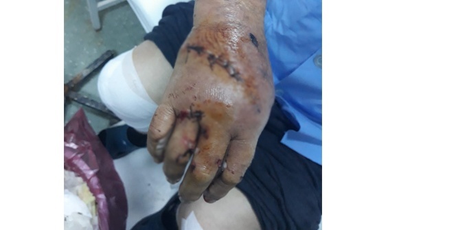 Denizli'de sokak ortasında demir sopayla dayak