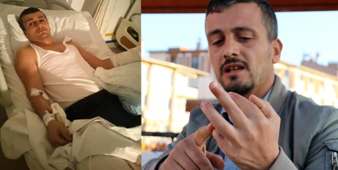 Kopan üç parmağı, patronunun yaptığı kadar acı vermedi