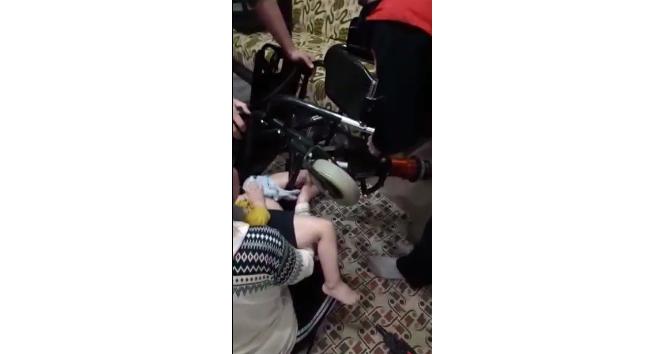 3 yaşındaki çocuğun ayağı tekerlekli sandalyeye sıkıştı