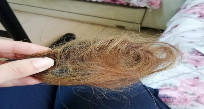 Hasta yakını genç kızın sağlık çalışanını darp edip saçını kopardığı iddiası