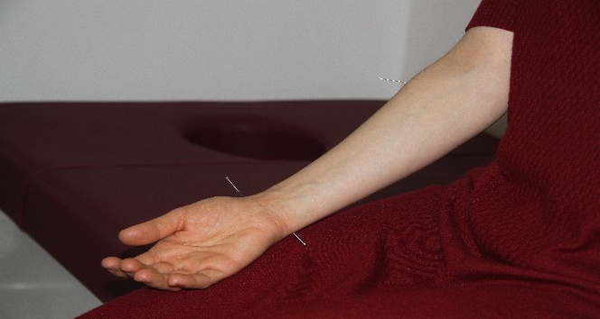 Isparta Şehir Hastanesi’nde akupunktur ile ilaçsız tedavi dönemi