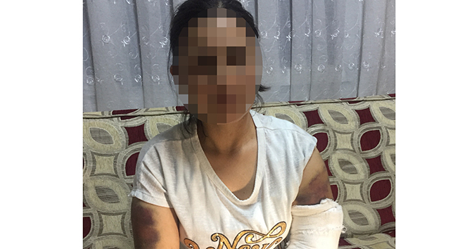 Kocası inşaat demiriyle döverek bu hale getirdi