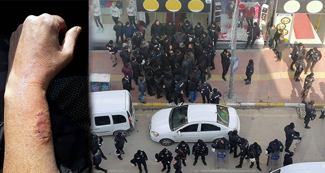 HDP'li vekil polis memurunun kolunu ısırdı