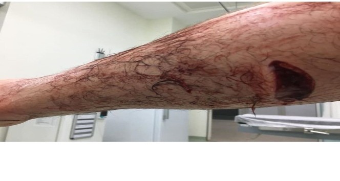 Domuz, avcıyı hastanelik etti, 20 bin liralık köpeğini öldürdü