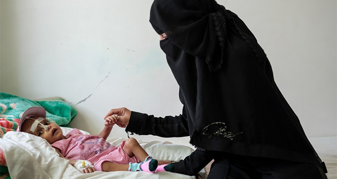 Yemen’de anne ve çocuklar ölüme terk ediliyor
