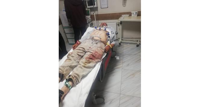 Karaman’da besicilerin mera kavgası kanlı bitti: 4 yaralı