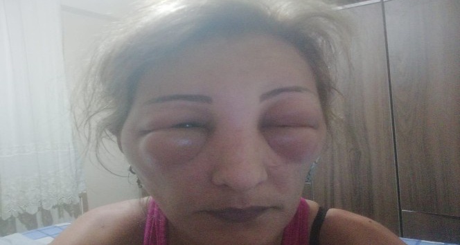 Saçlarını yaptırmak için kuaföre gitti, canından oluyordu