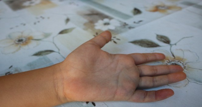 (Özel) Acı içinde kıvranan çocuklarını hastaneye götüren aileye yılan şoku