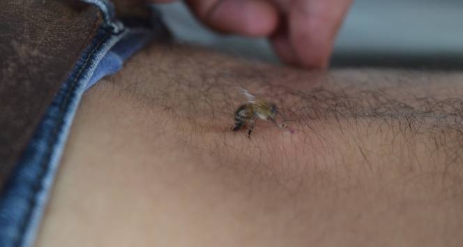 'Arı zehri birçok hastalığa iyi geliyor'