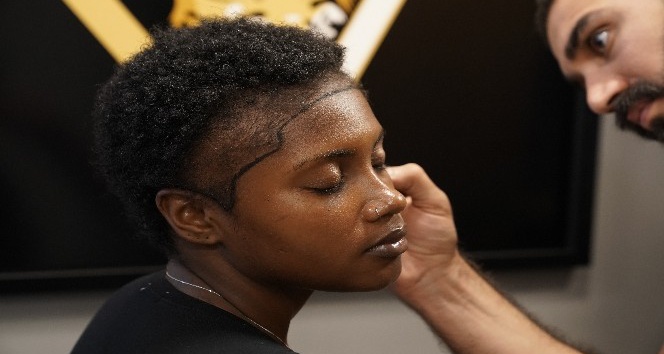 "Hair of İstanbul olarak ’Alın Daraltma’ operasyonlarına başladık"