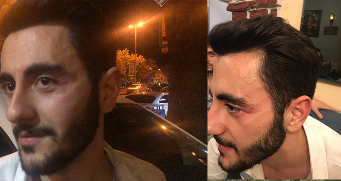 Reynmen gazetecilere saldırdı