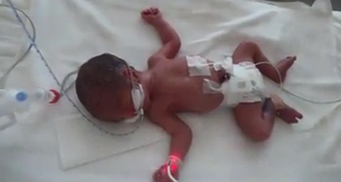 Kayseri Şehir Hastanesi’nin ilk dördüz bebekleri dünyaya geldi