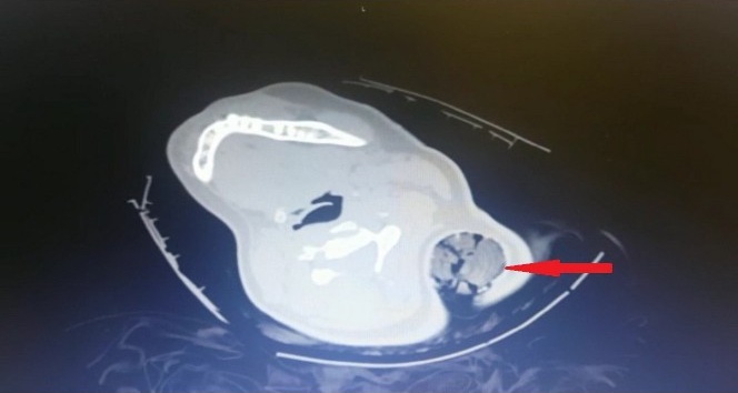 Kahramanmaraş’ta kaza sonrası inanılmaz kurtuluş