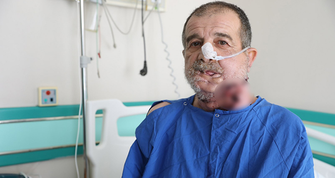 Kütahya’da bir hastaya bacaktan alınan kemikle yeni çene yapıldı